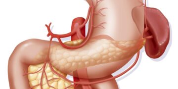 انقاذ حياة سعودي  من انفجار قرحة الإثني عشر