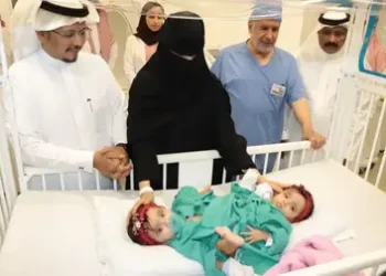 أدق عملية لفصل توأم سعودي:  جراحة على 9 مراحل خلال 15 ساعة  بمساعدة فريق من 38 فرداًمن اختصاصات مختلفة…