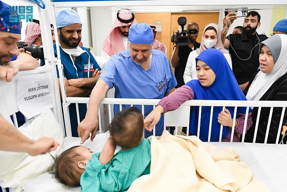 العملية ذات الرقم 67 تتمّ أيضاً بنجاح..التوأم السيامي الجاميكي انفصل الى اثنينوالسعودية تجدّد ريادتها في هذه الجراحة…