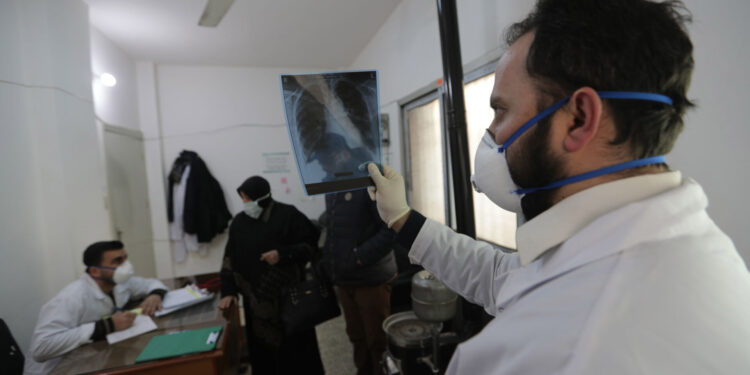 في اليوم العالمي لمكافحة السل:نعم يمكن القضاء عليهبقيادة البلدان وبدعم من الناس..Who EMRO: انسان واحد يفقد حياتهكل 6 دقائق بسبب هذا المرض...