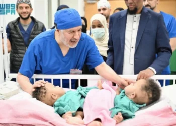 نجاح فصل التوأم الملتصق الصومالي"رحمة و رملا" بعد عملية جراحية معقدةاستغرقت 12 ساعة