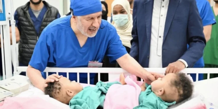 نجاح فصل التوأم الملتصق الصومالي"رحمة و رملا" بعد عملية جراحية معقدةاستغرقت 12 ساعة