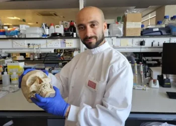 مادة مبتكرة من الصوف لعلاج كسور العظام