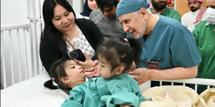 نجاح عملية فصل التوأم الفلبيني الملتصق«أوليفيا وجيانا» في الرياض