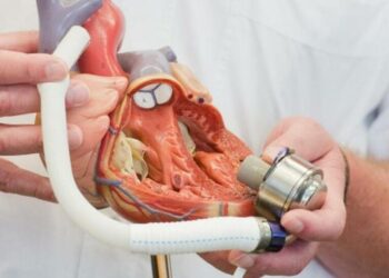الأولى من نوعها في العالم:صمامات قلب اصطناعيةتسهِم في علاج أمراض القلب