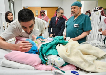 نجاح عملية فصلالتوأم الملتصق المغربي«سجى وضحى»